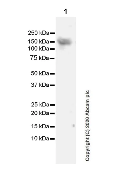 Western blot - Anti-KDM3A / JHDM2A antibody [EPR18875-106] (AB243641)