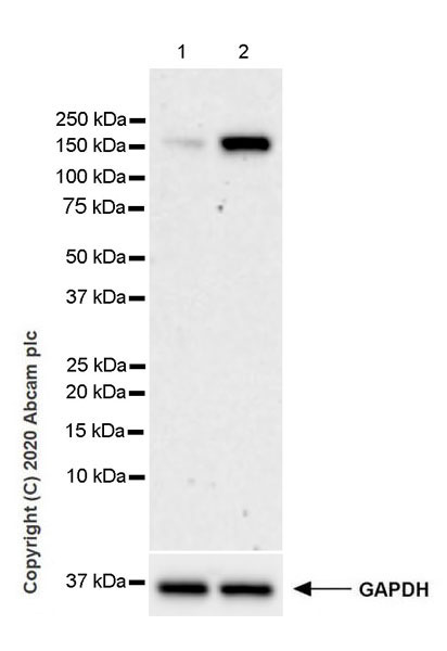 Western blot - Anti-KDM3A / JHDM2A antibody [EPR18875-106] (AB243641), expandable thumbnail