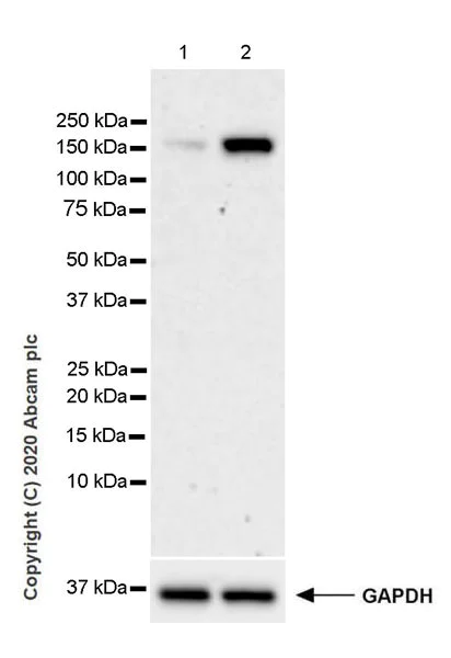 Western blot - Anti-KDM3A / JHDM2A antibody [EPR18875-106] (AB243641)