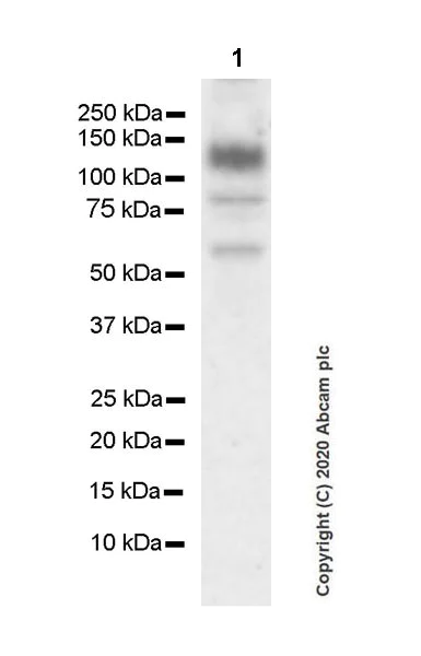 Western blot - Anti-KDM3A / JHDM2A antibody [EPR18875-106] (AB243641)