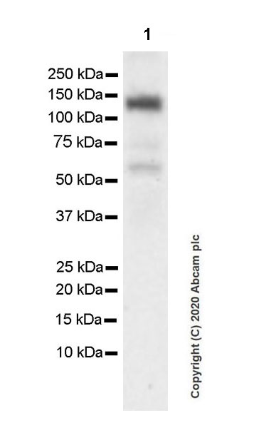 Western blot - Anti-KDM3A / JHDM2A antibody [EPR18875-106] (ab243641), expandable thumbnail