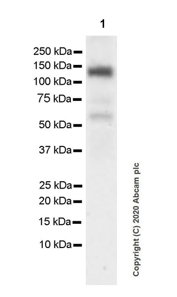 Western blot - Anti-KDM3A / JHDM2A antibody [EPR18875-106] (AB243641)