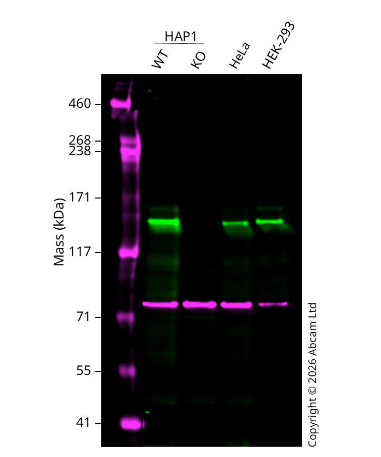Western blot - Anti-KDM3A / JHDM2A antibody [EPR18875-106] (AB243641)