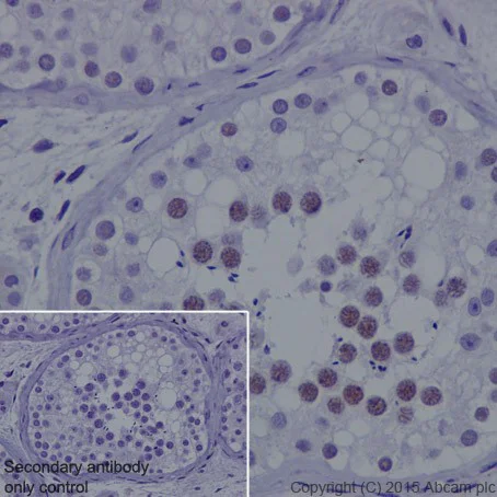 Immunohistochemistry (Formalin/PFA-fixed paraffin-embedded sections) - Anti-KDM3A / JHDM2A antibody [EPR18875] (AB191389)