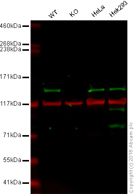 Western blot - Anti-KDM3A / JHDM2A antibody [EPR18875] - BSA and Azide free (AB251059)