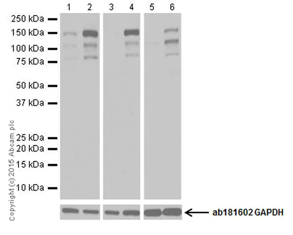 Western blot - Anti-KDM3A / JHDM2A antibody [EPR18875] - BSA and Azide free (AB251059)