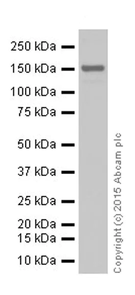 Western blot - Anti-KDM3A / JHDM2A antibody [EPR18875] - BSA and Azide free (AB251059)