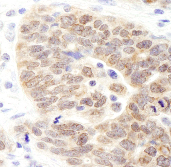 Immunohistochemistry (Formalin/PFA-fixed paraffin-embedded sections) - Anti-KDM3B / JMJD1B antibody (AB70797)