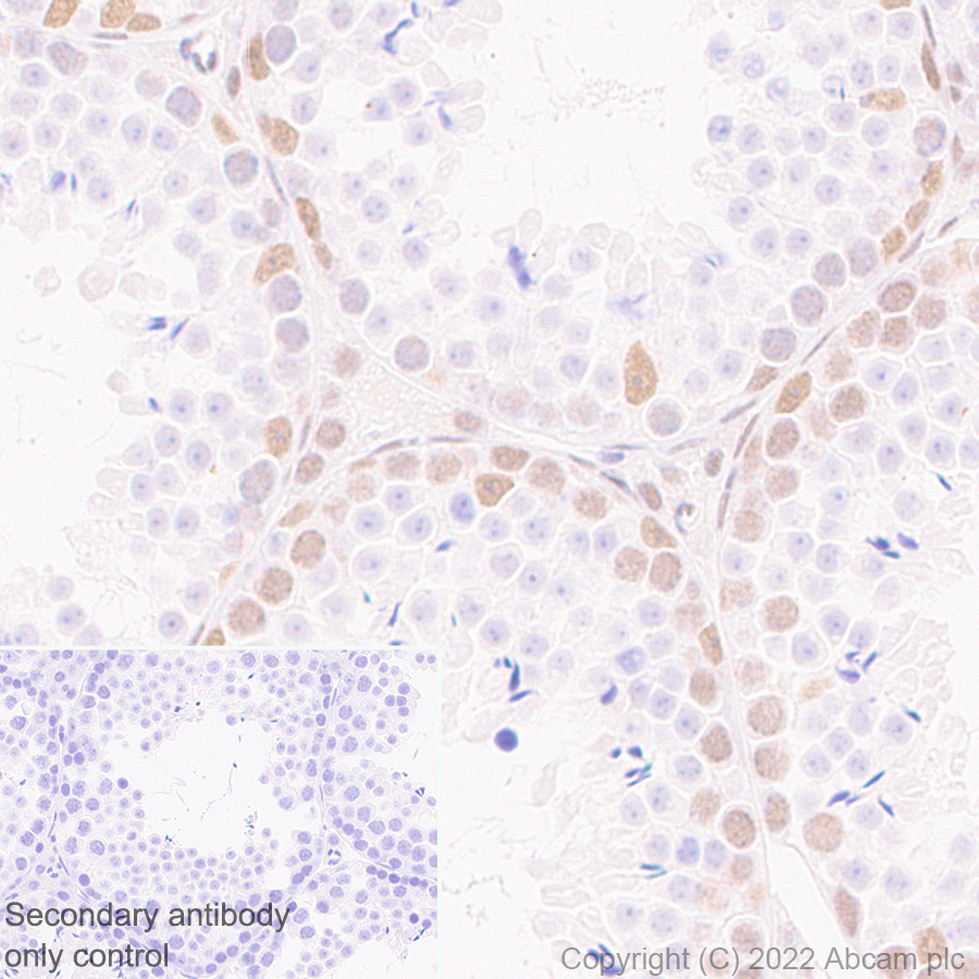 Immunohistochemistry (Formalin/PFA-fixed paraffin-embedded sections) - Anti-KDM3B / JMJD1B antibody [EPR24219-30] (ab271046), expandable thumbnail