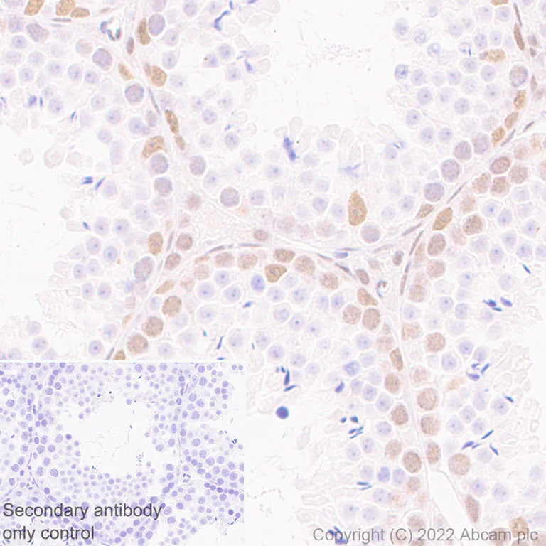 Immunohistochemistry (Formalin/PFA-fixed paraffin-embedded sections) - Anti-KDM3B / JMJD1B antibody [EPR24219-30] (AB271046)