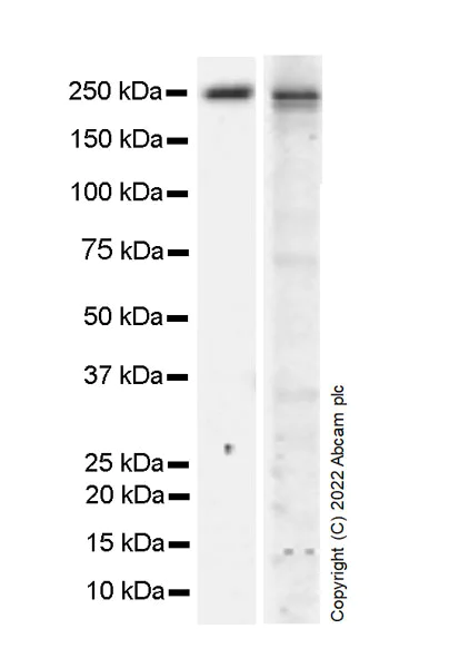 Western blot - Anti-KDM3B / JMJD1B antibody [EPR24219-30] - BSA and Azide free (AB289868)