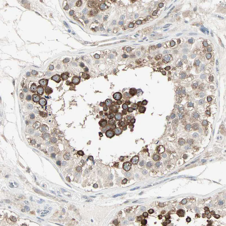 Immunohistochemistry (Formalin/PFA-fixed paraffin-embedded sections) - Anti-KDM4A Antibody (AB327187)