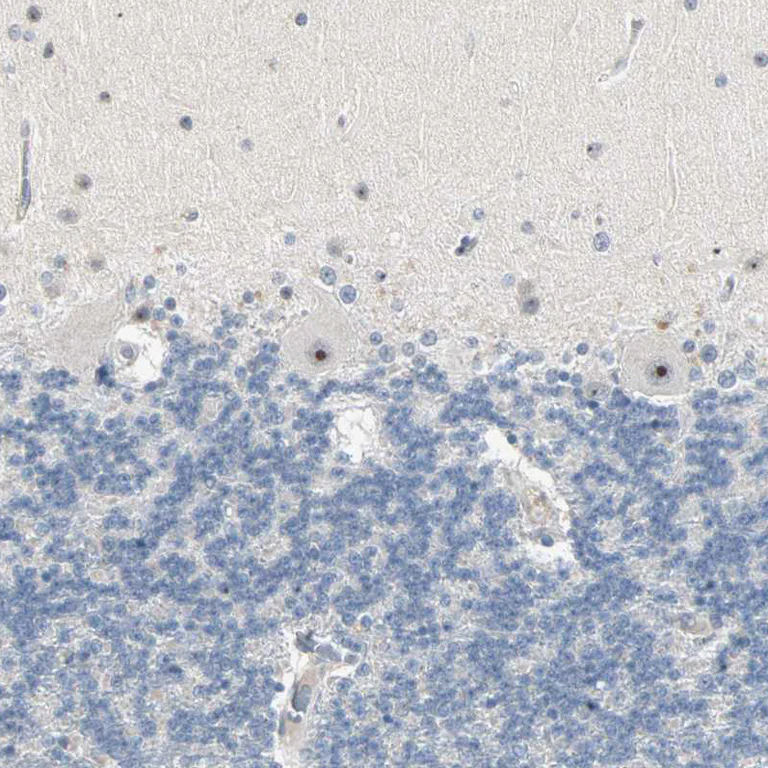 Immunohistochemistry (Formalin/PFA-fixed paraffin-embedded sections) - Anti-KDM4A Antibody (AB327187)
