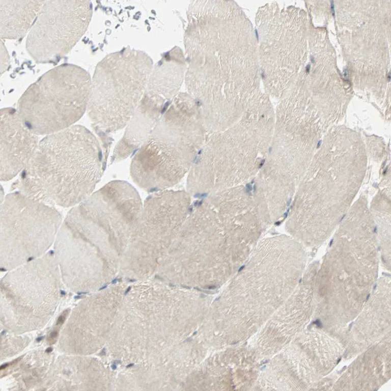 Immunohistochemistry (Formalin/PFA-fixed paraffin-embedded sections) - Anti-KDM4A Antibody (AB327187)
