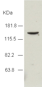 Western blot - Anti-KDM4A / JHDM3A / JMJD2A antibody (AB24545), expandable thumbnail