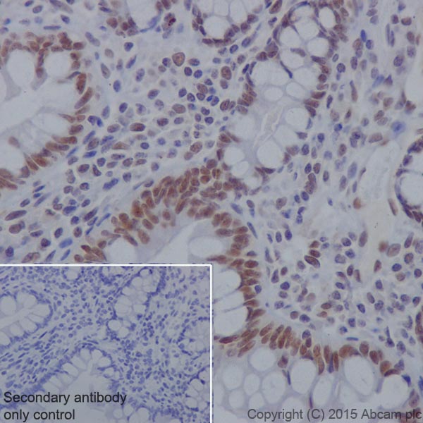 Immunohistochemistry (Formalin/PFA-fixed paraffin-embedded sections) - Anti-KDM4A / JHDM3A / JMJD2A antibody [EPR18466] (AB191433)
