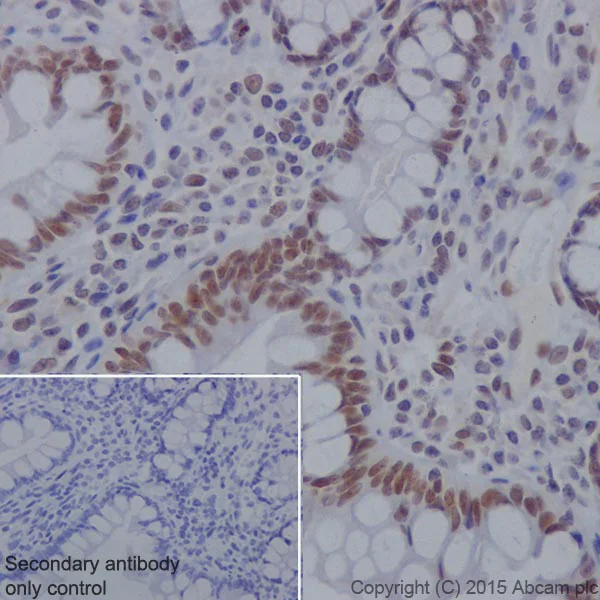 Immunohistochemistry (Formalin/PFA-fixed paraffin-embedded sections) - Anti-KDM4A / JHDM3A / JMJD2A antibody [EPR18466] (AB191433)