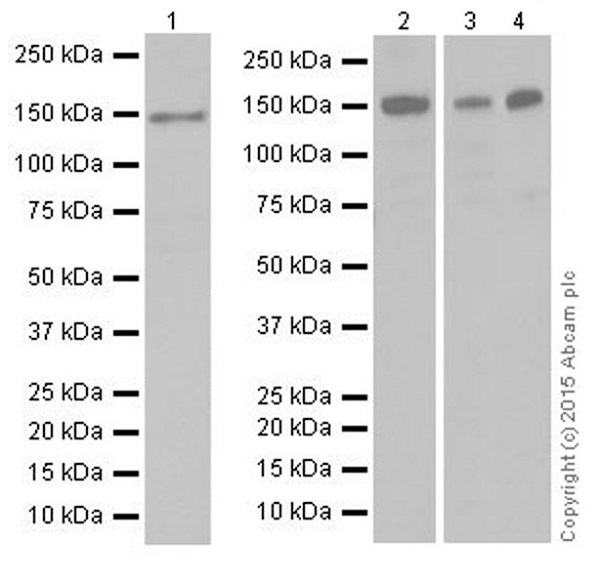 Western blot - Anti-KDM4A / JHDM3A / JMJD2A antibody [EPR18466] (AB191433)