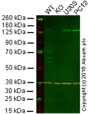 Western blot - Anti-KDM4A / JHDM3A / JMJD2A antibody [EPR18466] - BSA and Azide free (AB251084)