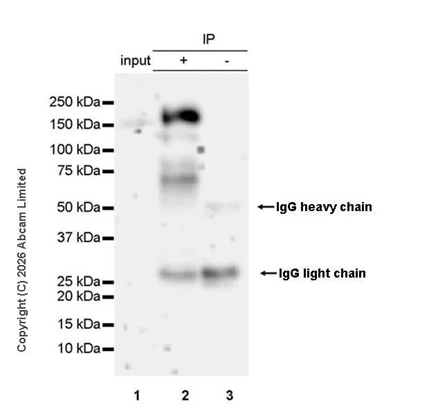 Immunoprecipitation - Anti-KDM4A / JHDM3A / JMJD2A antibody [EPR29602-146] (AB326104)
