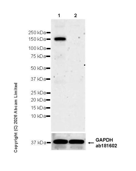 Western blot - Anti-KDM4A / JHDM3A / JMJD2A antibody [EPR29602-146] (AB326104)