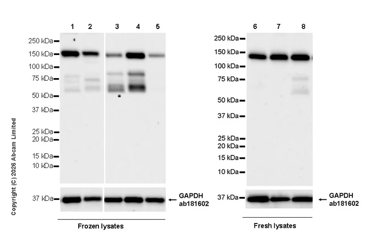 Western blot - Anti-KDM4A / JHDM3A / JMJD2A antibody [EPR29602-146] (AB326104)