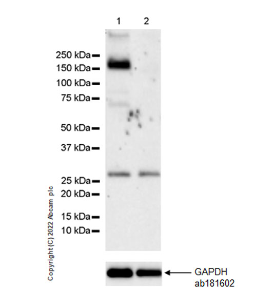 Western blot - Anti-KDM4B / JMJD2B antibody [EPR25240-41] - BSA and Azide free (AB305057), expandable thumbnail