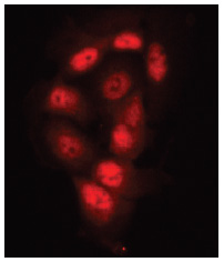 Immunocytochemistry/ Immunofluorescence - Anti-KDM4D / JMJD2D antibody (AB93694)