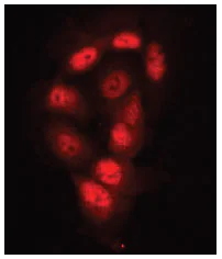 Immunocytochemistry/ Immunofluorescence - Anti-KDM4D / JMJD2D antibody (AB93694)