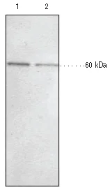 Western blot - Anti-KDM4D / JMJD2D antibody (AB93694)