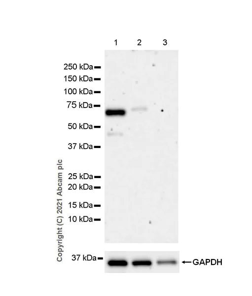 Western blot - Anti-KDM4D / JMJD2D antibody [EPR25241-24] (AB289667)