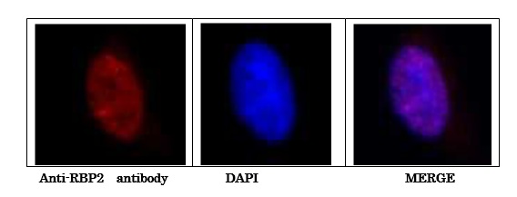 Immunocytochemistry/ Immunofluorescence - Anti-KDM5A / Jarid1A / RBBP2 antibody [18E8] (AB78322)