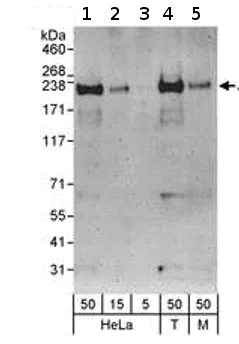 Western blot - Anti-KDM5A / Jarid1A / RBBP2 antibody (AB70892)