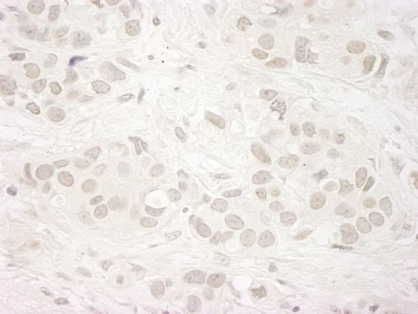Immunohistochemistry (Formalin/PFA-fixed paraffin-embedded sections) - Anti-KDM5A / Jarid1A / RBBP2 antibody (AB92533)