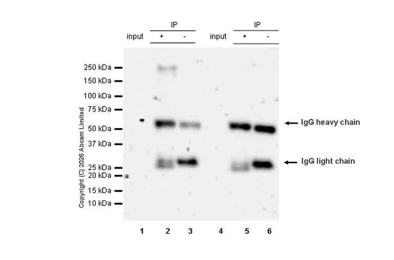 Immunoprecipitation - Anti-KDM5A / Jarid1A / RBBP2 antibody [EPR12742] - BSA and Azide free (AB249990)