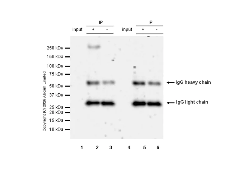 Immunoprecipitation - Anti-KDM5A / Jarid1A / RBBP2 antibody [EPR18651] - BSA and Azide free (AB251183)