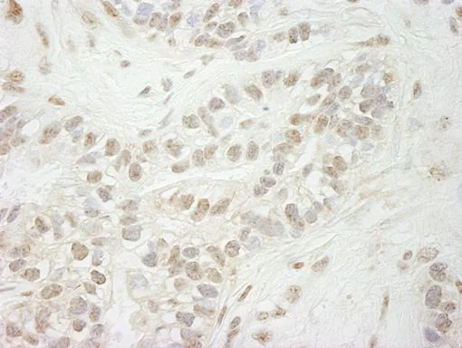 Immunohistochemistry (Formalin/PFA-fixed paraffin-embedded sections) - Anti-KDM5B / PLU1 / Jarid1B antibody (AB84883)