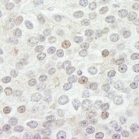 Immunohistochemistry (Formalin/PFA-fixed paraffin-embedded sections) - Anti-KDM5B / PLU1 / Jarid1B antibody (AB84883)