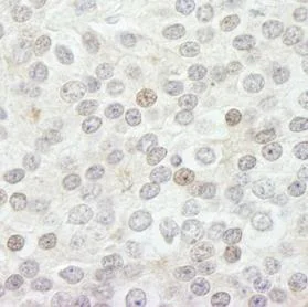 Immunohistochemistry (Formalin/PFA-fixed paraffin-embedded sections) - Anti-KDM5B / PLU1 / Jarid1B antibody (AB84883)