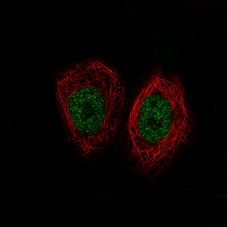 Immunocytochemistry/ Immunofluorescence - Anti-KDM5B / PLU1 / Jarid1B antibody [CL1129] (AB244220)