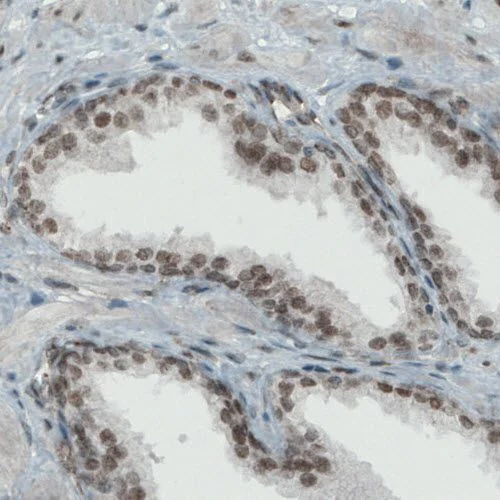 Immunohistochemistry (Formalin/PFA-fixed paraffin-embedded sections) - Anti-KDM5B / PLU1 / Jarid1B antibody [CL1129] (AB244220)