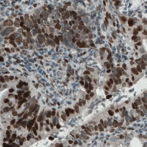 Immunohistochemistry (Formalin/PFA-fixed paraffin-embedded sections) - Anti-KDM5B / PLU1 / Jarid1B antibody [CL1129] (AB244220)