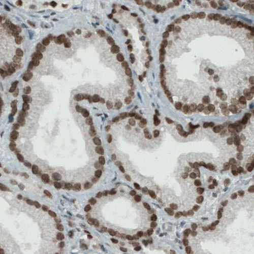 Immunohistochemistry (Formalin/PFA-fixed paraffin-embedded sections) - Anti-KDM5B / PLU1 / Jarid1B antibody [CL1129] (AB244220)