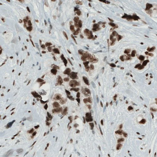 Immunohistochemistry (Formalin/PFA-fixed paraffin-embedded sections) - Anti-KDM5B / PLU1 / Jarid1B antibody [CL1129] (AB244220)