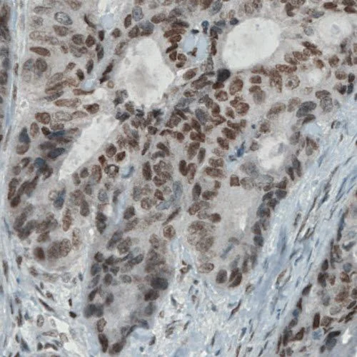 Immunohistochemistry (Formalin/PFA-fixed paraffin-embedded sections) - Anti-KDM5B / PLU1 / Jarid1B antibody [CL1129] (AB244220)