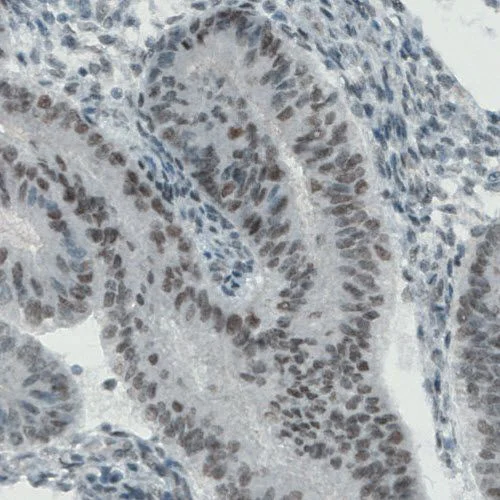 Immunohistochemistry (Formalin/PFA-fixed paraffin-embedded sections) - Anti-KDM5B / PLU1 / Jarid1B antibody [CL1129] (AB244220)