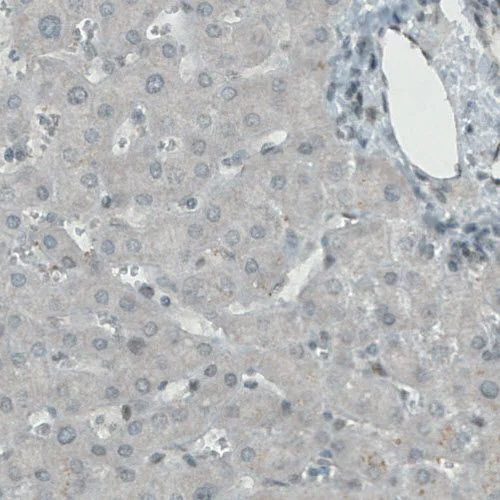 Immunohistochemistry (Formalin/PFA-fixed paraffin-embedded sections) - Anti-KDM5B / PLU1 / Jarid1B antibody [CL1129] (AB244220)