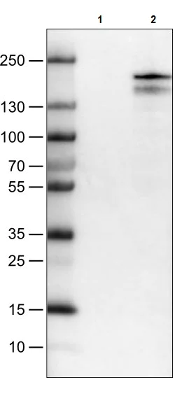 Western blot - Anti-KDM5B / PLU1 / Jarid1B antibody [CL1129] (AB244220)