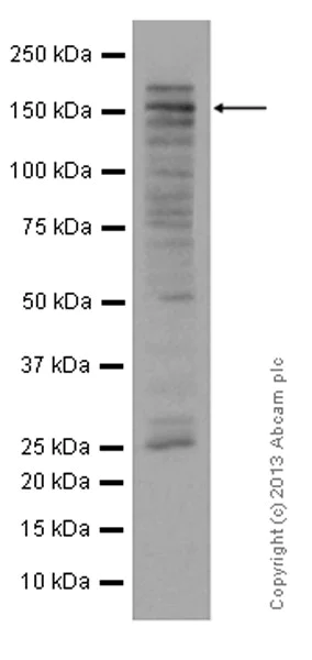 Western blot - Anti-KDM5B / PLU1 / Jarid1B antibody [EPR12704] (AB181089)