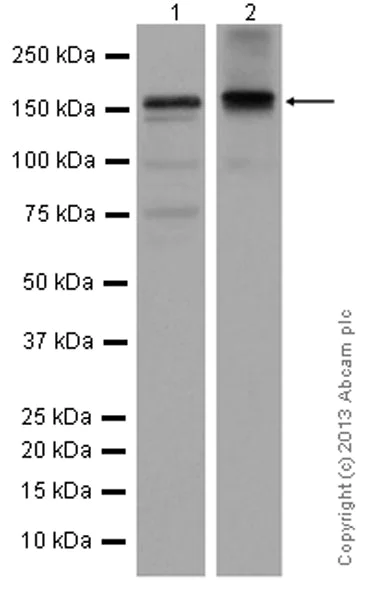 Western blot - Anti-KDM5B / PLU1 / Jarid1B antibody [EPR12704] - BSA and Azide free (AB232590)